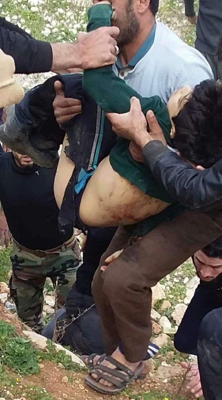 مقتل طفل بانفجار لغم أرضي في مدينة عفرين