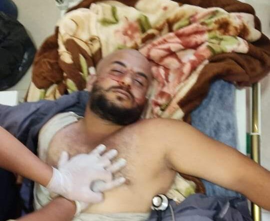 IDP from Idlib was killed in a  camp on the outskirts of Afrin