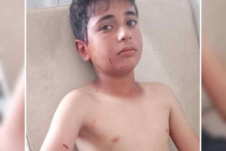 Child injured as Turkish forces shelled Abbin village, northern Aleppo