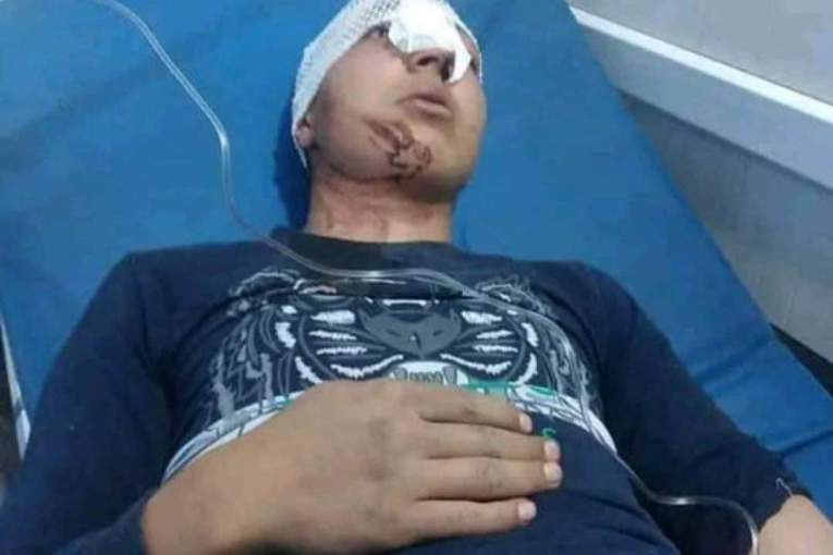 Jaish al-Sharqiya Brutally Attacked Kurdish Teenager in Afrin