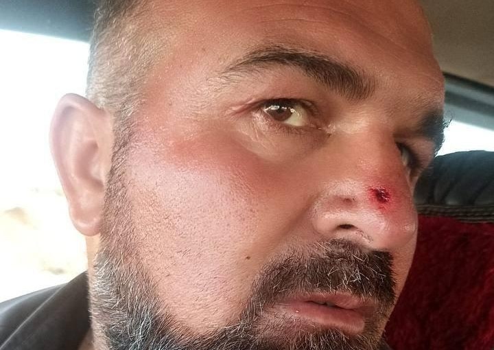 Kurdish Villager Attacked and Abused by Militia at Al-Bab Checkpoint