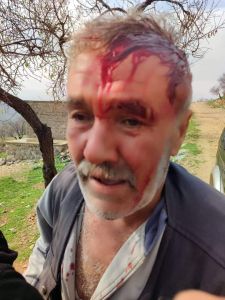 Ongoing Assault Against Kurdish Elderlies in Afrin