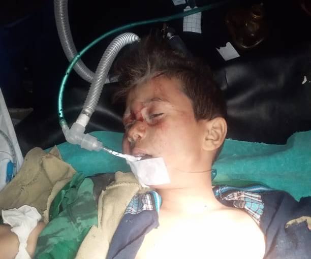 Child martyred in Al-Shahba areas due to the explosion of a landmine