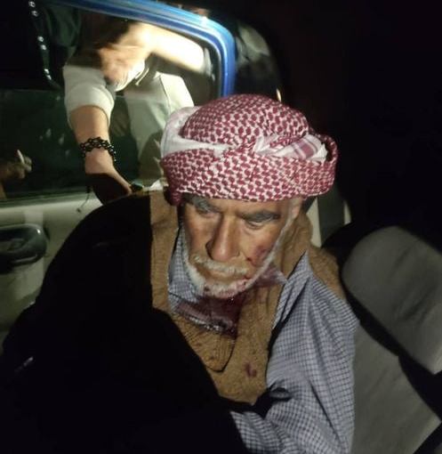 Old Kurdish man dies of his injuries during pro-Turkey militias clashes in Bulbul, Afrin