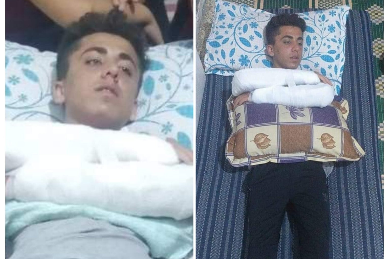 Attempted Assassination of Young Man in Jindires by Turkish-Backed Militants