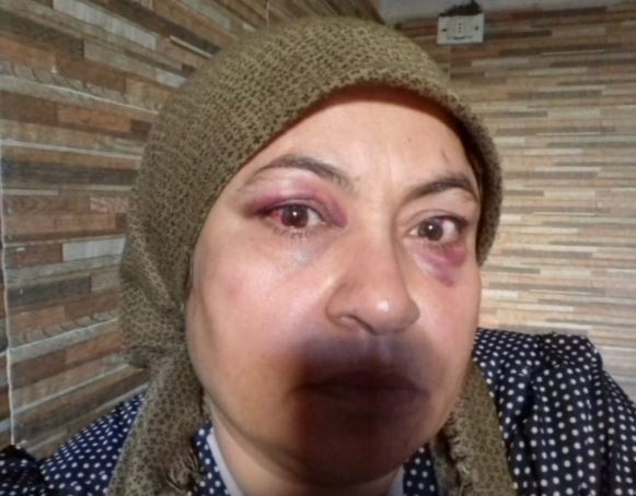 Niştedagîrên Xûtanî mala jineke Kurd desteser kir û bi serde jî bi giranî lê da